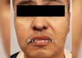 Depravado fingió ser médico e hipnotista para violar a mujer en CDMX