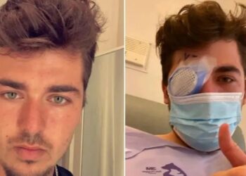 Toma una siesta, despierta y PARÁSITOS habían comido su OJO