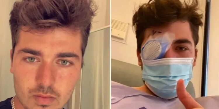 Toma una siesta, despierta y PARÁSITOS habían comido su OJO