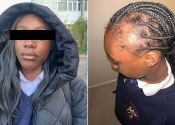 Denuncia que sufre bullying y muestra su cráneo calvo por jalones de cabello