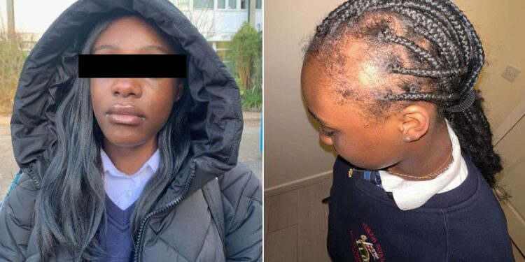 Denuncia que sufre bullying y muestra su cráneo calvo por jalones de cabello