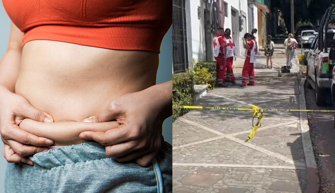 Intenta hacerse una “lipo” ella misma y termina muerta en Cuernavaca