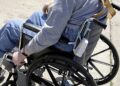 “Patitas desconchabaditas”: le amputan una pierna y por error fracturan la otra en hospital