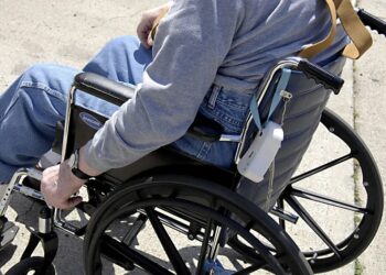 “Patitas desconchabaditas”: le amputan una pierna y por error fracturan la otra en hospital