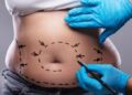 Video. Fingió tener CÁNCER para que le dieran DINERO y con él ¡se hizo la “lipo”!