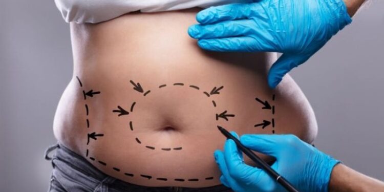 Video. Fingió tener CÁNCER para que le dieran DINERO y con él ¡se hizo la “lipo”!