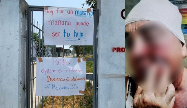 Adolescente le «rompe» la cabeza de un martillazo a maestro por reprobarlo