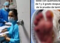 Video. GOLPEA a enfermera que le dio a su BEBÉ con quemaduras tras el «Tamiz»