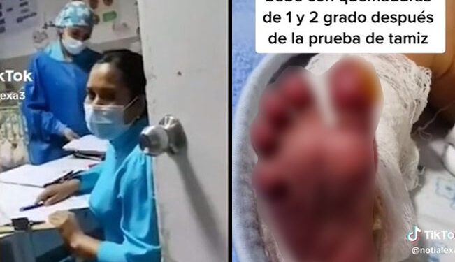 Video. GOLPEA a enfermera que le dio a su BEBÉ con quemaduras tras el «Tamiz»