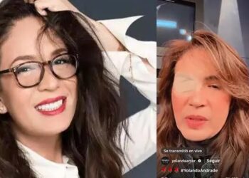  Yolanda Andrade reaparece en TV con un parche, debido a la enfermedad que enfrenta