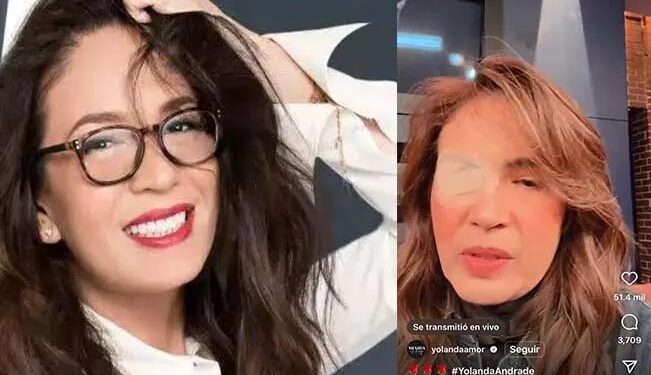 Yolanda Andrade reaparece en TV con un parche, debido a la enfermedad que enfrenta