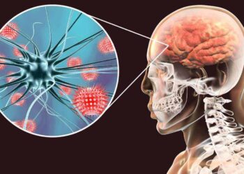 Confirman en Matamoros 6 casos del hongo que provoca la meningitis