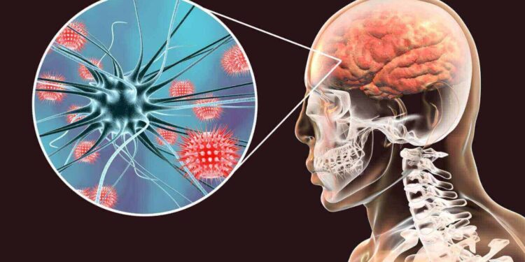 Confirman en Matamoros 6 casos del hongo que provoca la meningitis
