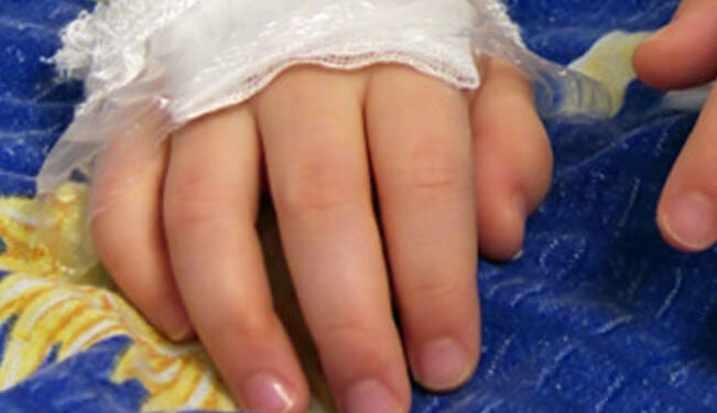 Despiadada le QUEMA la MANO a su niño en el comal por “portarse mal”