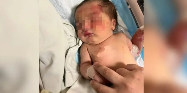 ¡Ángel de 4 patitas!: PERRITO salva a BEBÉ arrojada a la basura; la llevó a sitio seguro