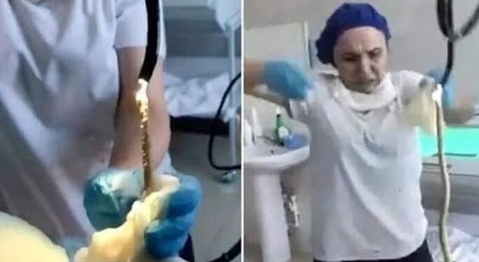 Video. ¡Pesadilla!, le extraen SERPIENTE que entró por su boca mientras DORMÍA