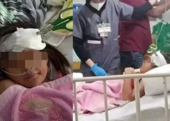 ¡NIÑA pasa 7 días con TIJERAS clavadas en la cabecita por no tener $ para la cirugía!
