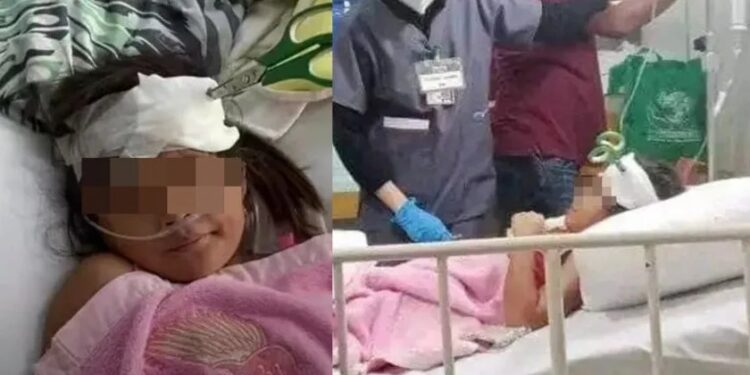 ¡NIÑA pasa 7 días con TIJERAS clavadas en la cabecita por no tener $ para la cirugía!