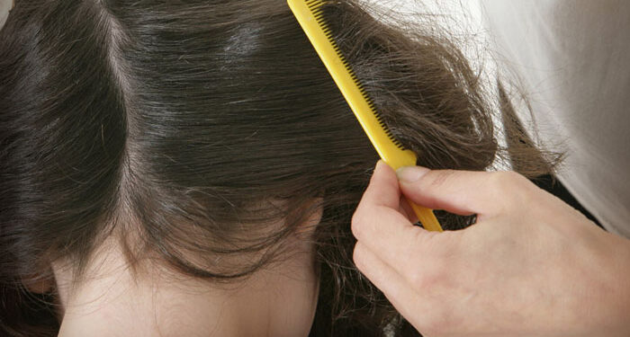 “No les quiero hacer daño”: mamá vegana deja que NIÑA se infeste de PIOJOS