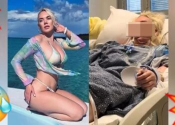 AMPUTAN pierna a modelo al infectarse de bacteria CARNÍVORA en una playa