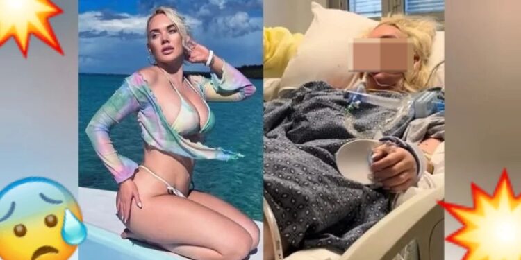 AMPUTAN pierna a modelo al infectarse de bacteria CARNÍVORA en una playa