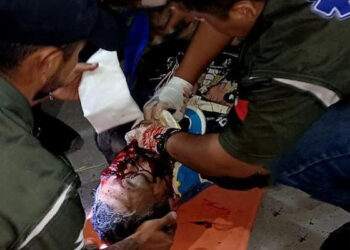 ‘Al filo de la MUERTE’: motociclista GRAVE tras ser ARROLLADO en Matamoros