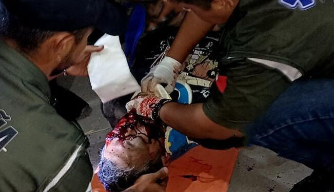 ‘Al filo de la MUERTE’: motociclista GRAVE tras ser ARROLLADO en Matamoros